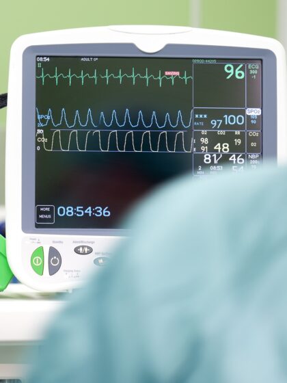image of a an EKG machine with a health care provider in the foreground
